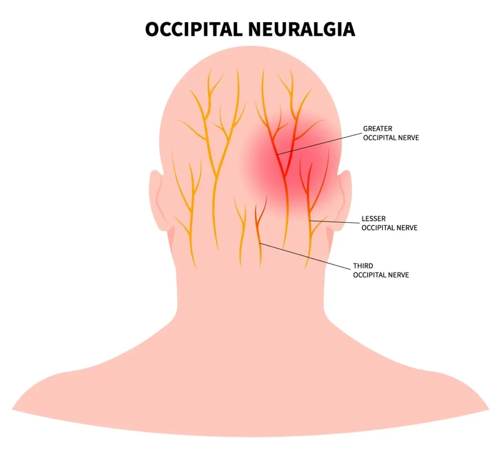 back head