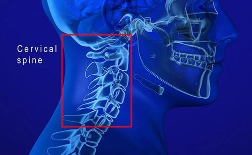 C3-C4 Disc Bulge Symptoms